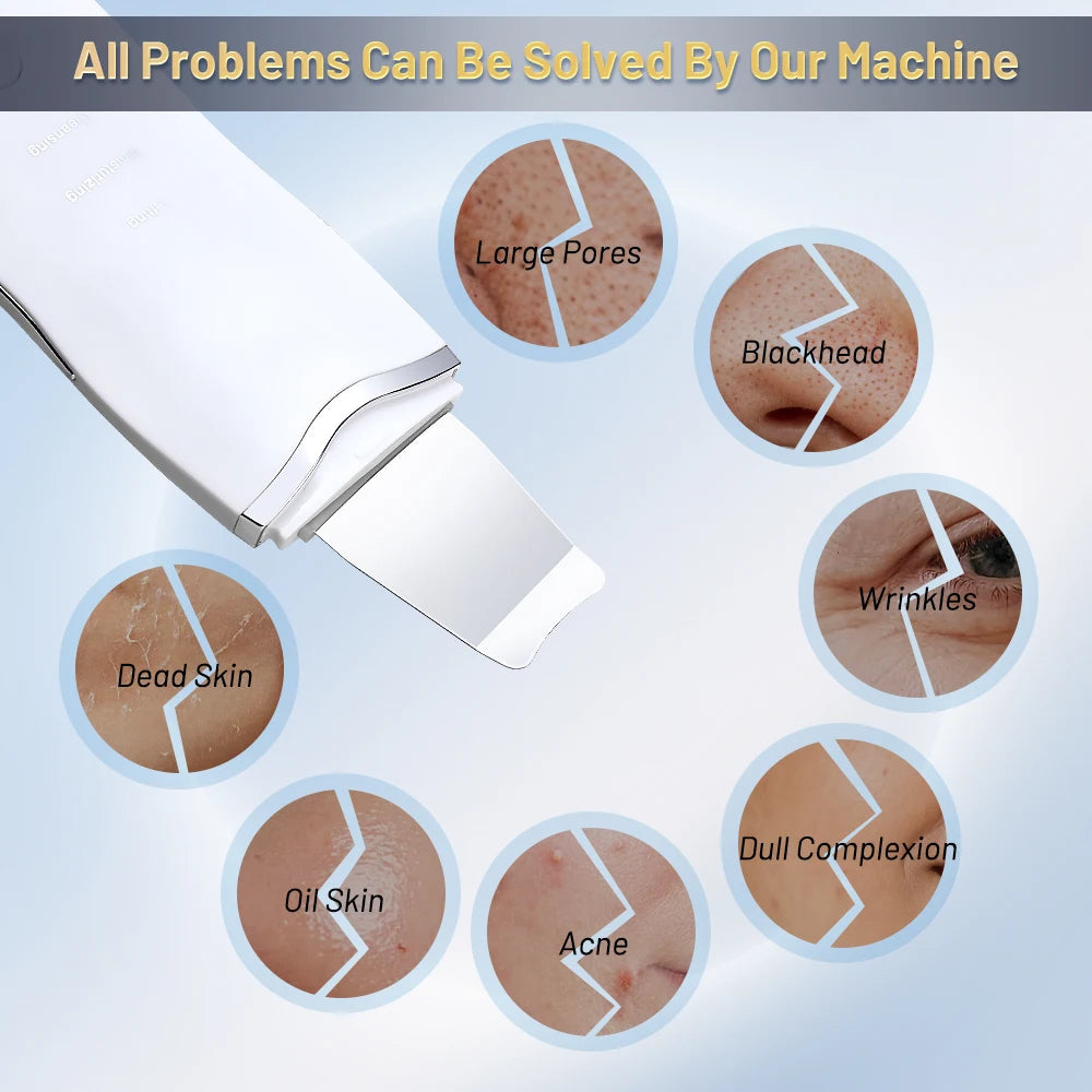 Ultrasonic Skin Scrubber Ance Pore Cleaner