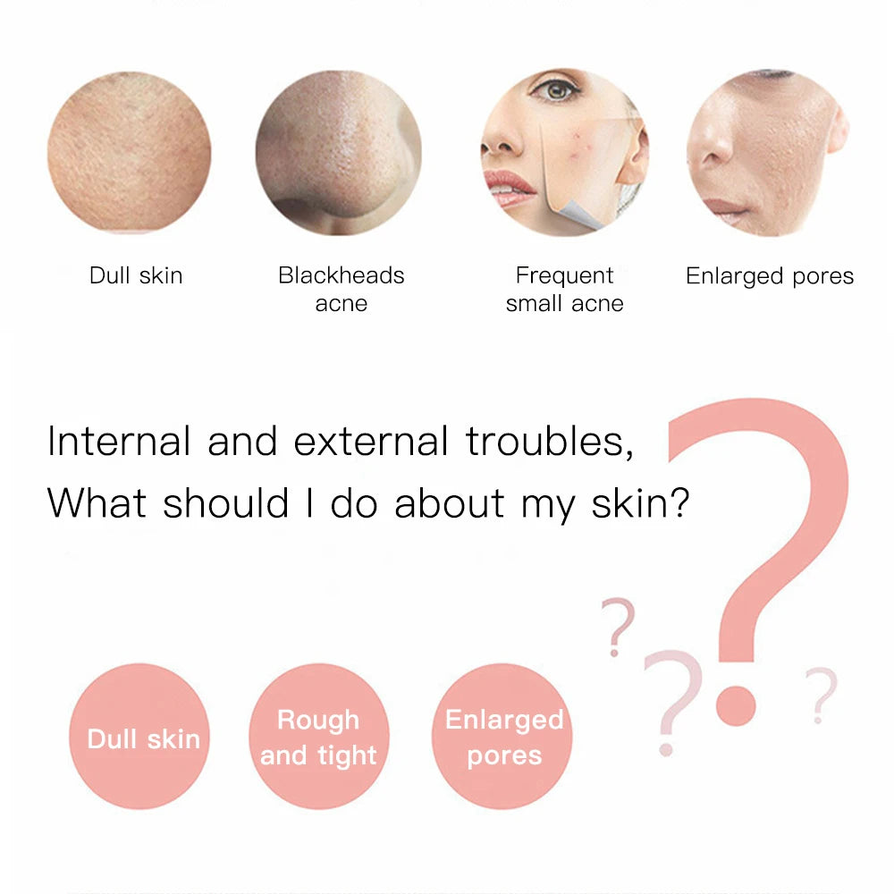 Ultrasonic Skin Scrubber Ance Pore Cleaner
