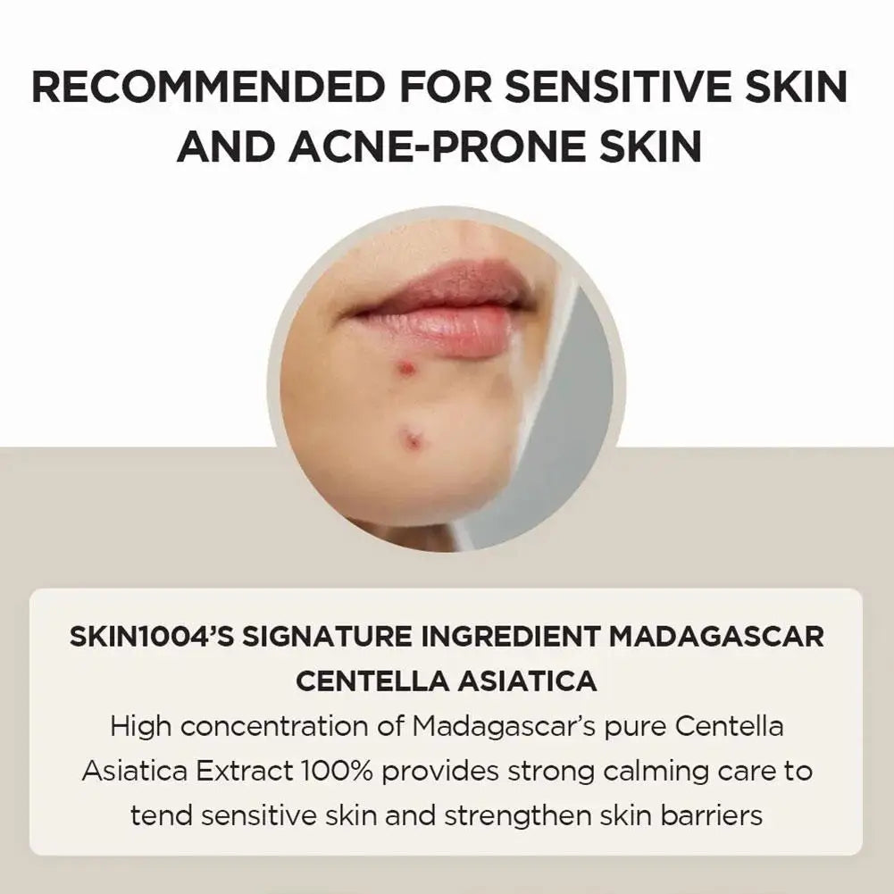 Toner Bottle Facial Ampoule Oil Control Remove Acne