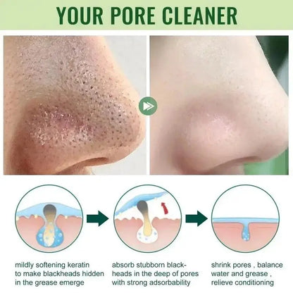 Facial Remove Blackhead Solid Mask