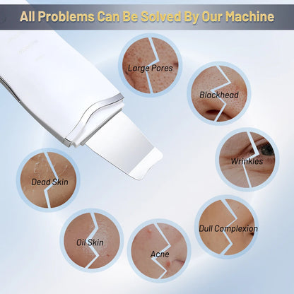 Ultrasonic Skin Scrubber Ance Pore Cleaner