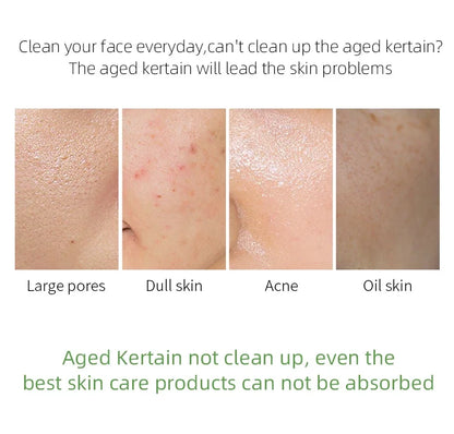 Gel Facial Scrub Moisturise Nourishing