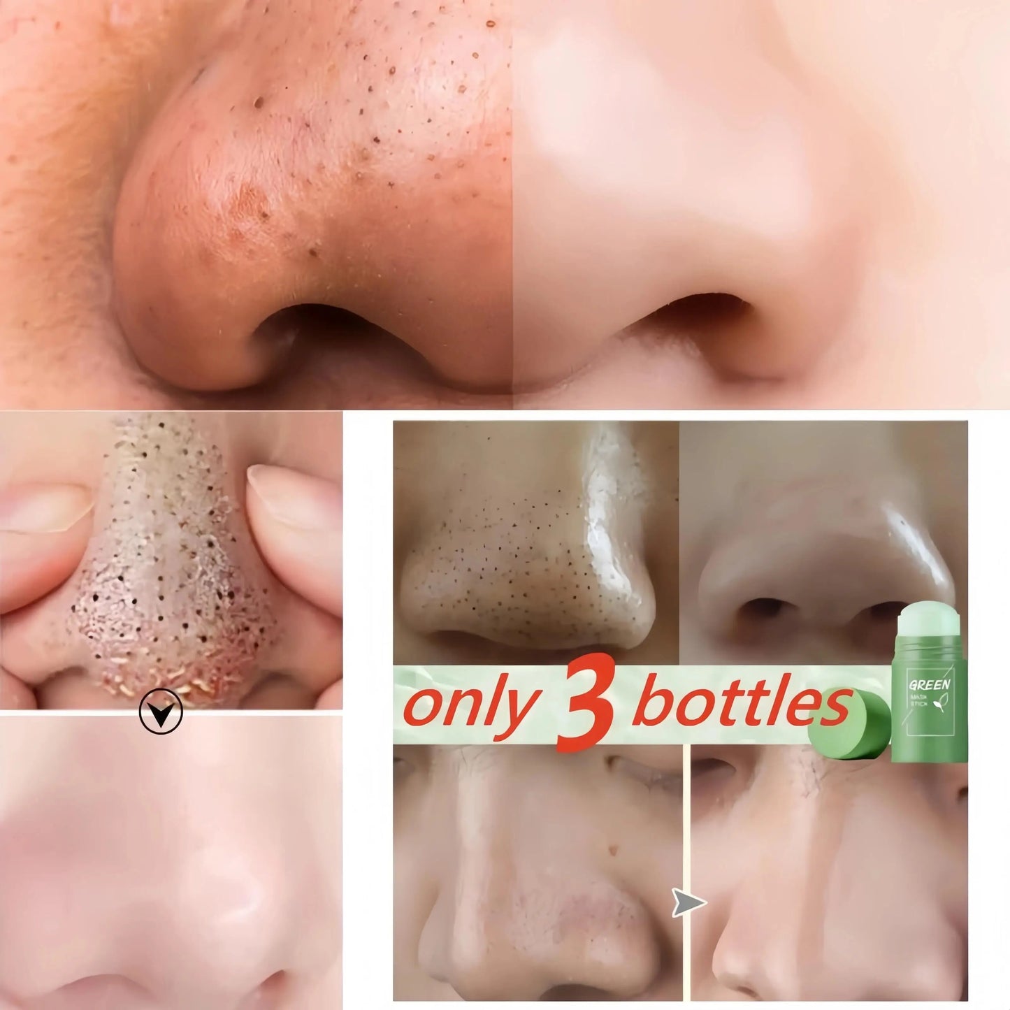 Facial Remove Blackhead Solid Mask