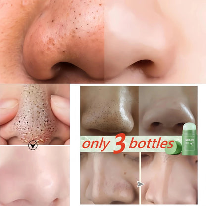 Facial Remove Blackhead Solid Mask