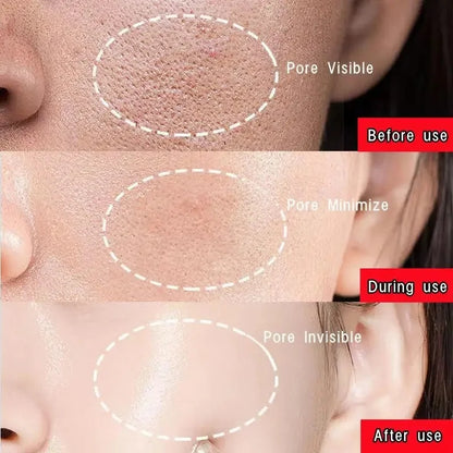 Facial Remove Blackhead Solid Mask