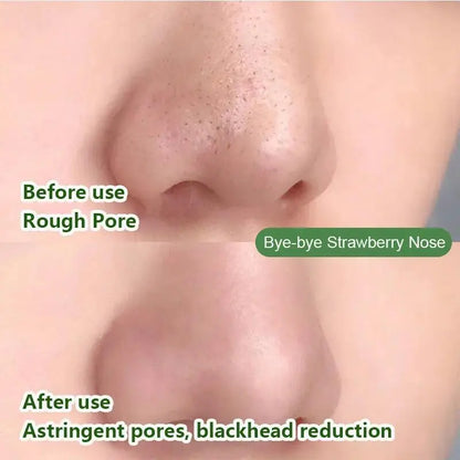 Facial Remove Blackhead Solid Mask