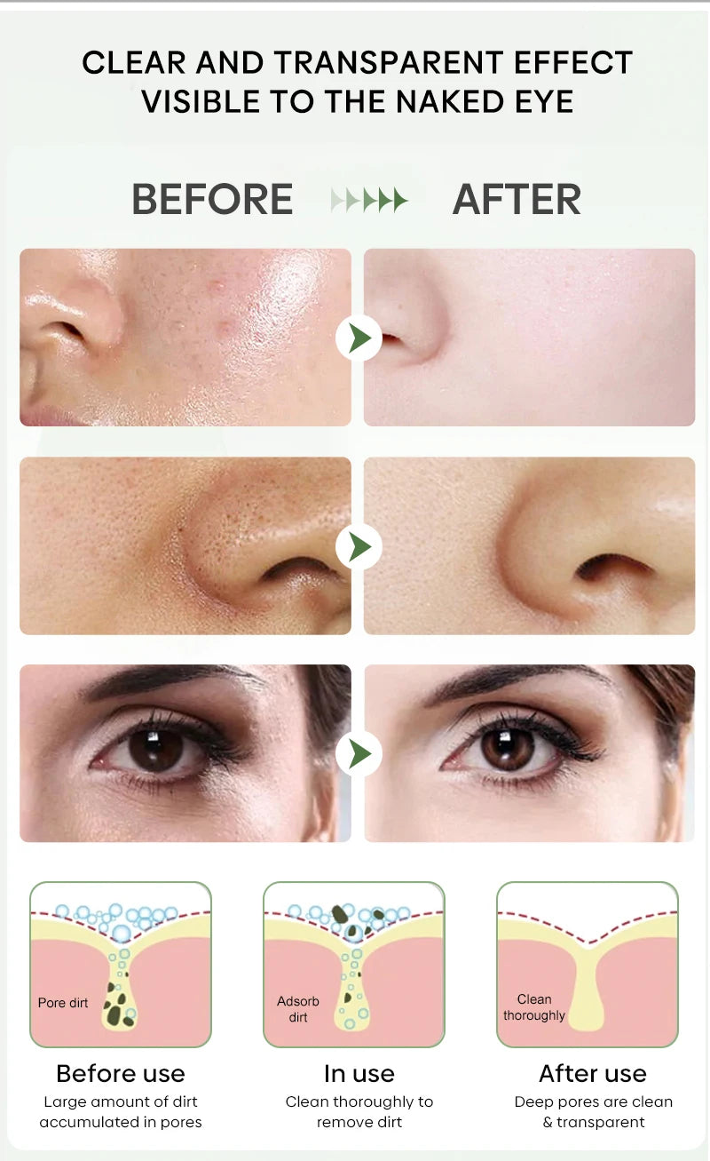 Facial Remove Blackhead Solid Mask