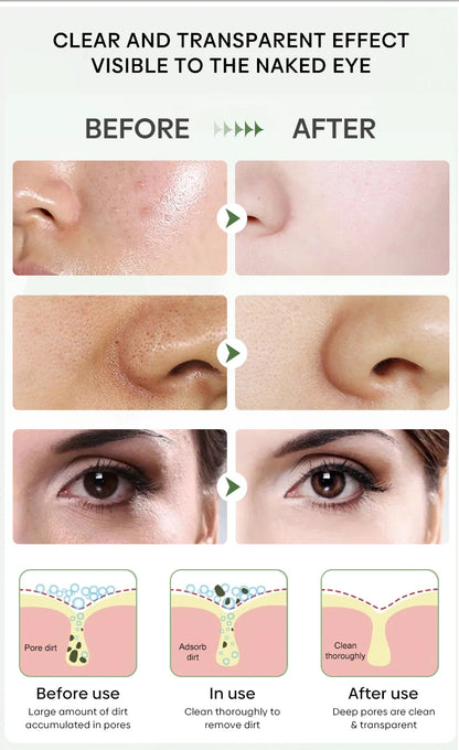 Facial Remove Blackhead Solid Mask